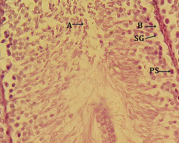 Section from seminiferous tubular of CCl4 group. A, loss of spermatogenic cells into the lumen; B, development of distance between the basement membrane and spermatogenic cells (H&E stain, 400 ×).