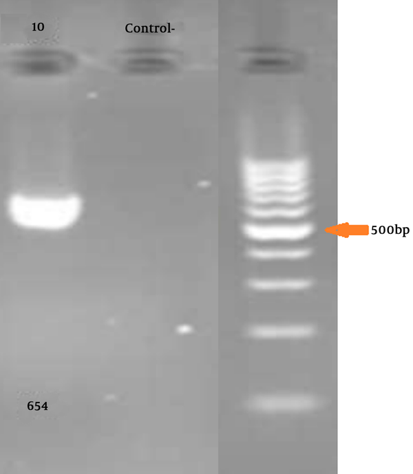 The picture indicates exon 10 with 654 bp length and negative control for the same PCR