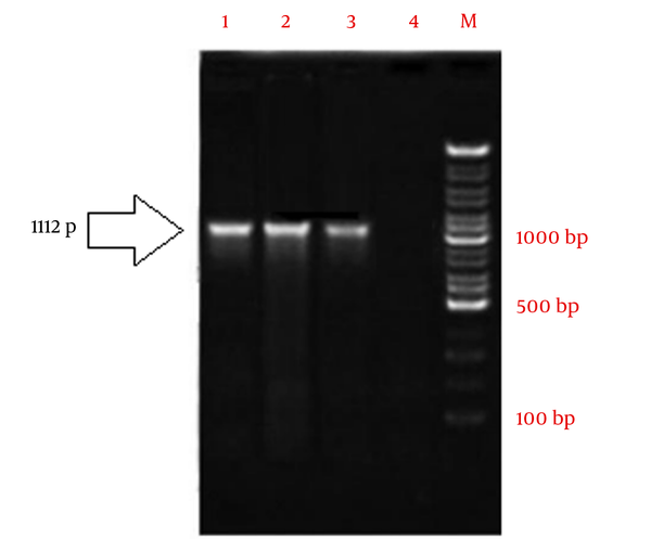 Amplification of ompA transcript through the RT-PCR. Lane 1 - 3 shows the amplified cDNA in RT-PCR using specific ompA primers. Lane 4 is negative control of the reaction. The lane M illustrates the100 bp DNA size marker.
