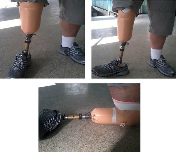 Ankle turner unit was used in this study