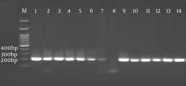 Amplification of 194 bp from Toxoplasma gondii DNA in the blood of HIV-infected patients. Lane M molecular weight marker; Lane1 positive control, Lane 2-7 and 9-14 positive samples and lane 8 negative control. Running condition: Agarose gel (2%).