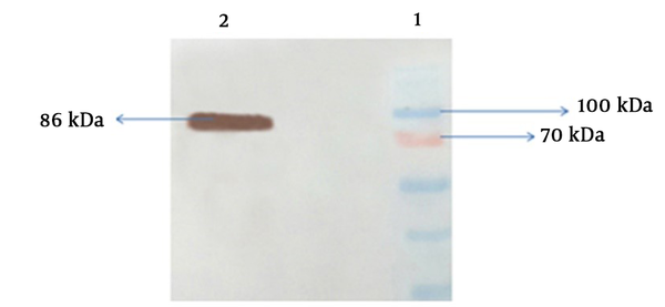 1, Western Blot analysis, protein ladder; 2, BL21 without plasmid