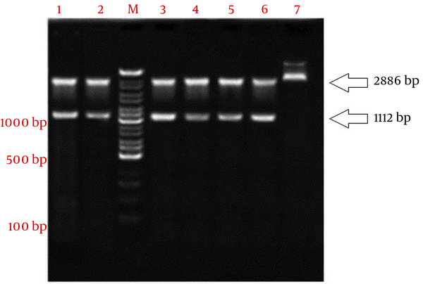 Analysis of recombinant plasmid (pTZ57RT-ompA) digested by two restrictive endonucleases HindIII and XhoI. Lane M, 100 bp DNA marker; lane 1 - 6, 2886 bp pTZ57RT fragment and 1112 bp ompA amplicon; lane 7, pTZ57RT-ompA undigested.