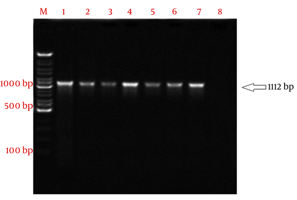 The PCR amplification of ompA gene from Acinetobacter baumannii isolates. Lane M, 100 bp DNA marker; lane 1 - 7, 1112 bp amplified ompA gene from A. baumannii strain; lane 8, negative control.