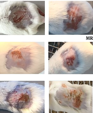 Treatment for S. aureus skin infection works in mouse model