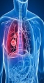 The Burden of Chronic Obstructive Pulmonary Disease and Its Risk Factors in the Iranian Population: Results from the Global Burden of Disease Study 2016