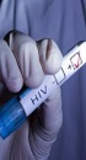Hepatitis C Infection Among HIV-Positive Injection Drug Users and Non-Injection-Drug Users in Tajikistan