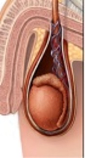 Epididymal or Testicular Ultrasonic Findings: Which One is More Reliable for Differentiation of Testicular Torsion from Epididymitis?