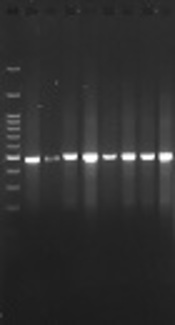 Isolation of CTX-M1, CTX-M2, CTX-M3 Genes Producing Extended-Spectrum Beta-Lactamase in Clinical Samples of Salmonella typhimurium