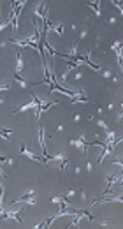 GMP-Compliant Human Fetal Skin Fibroblasts for Wound Healing