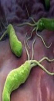 Helicobacter pylori Treatment: Potential for Gastric Cancer Prevention