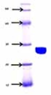 Optimization and Molecular Detection of Neuraminidase Gene in Listeria monocytogenes
