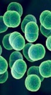 http://blog.microbiologics.com/environmental-isolate-case-files-staphylococcus-epidermidis/