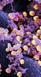 https://www.healththoroughfare.com/medicine/a-plant-from-australia-could-cure-diseases-caused-by-the-staphylococcus-aureus/1097