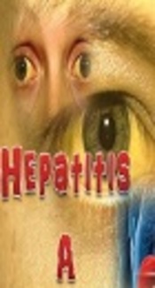Hepatitis A, From Pain