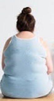 Effects of Overweight and Obesity on Postural Stability of Aging Females