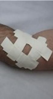 The Immediate Effect of Taping and Counterforce Brace on Pain and Grip Strength in Patients with Tennis Elbow