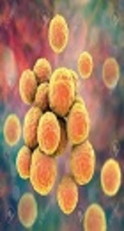 High Frequency of Methicillin-Resistant Staphylococcus aureus in Intensive Care Unit in Karaj, Iran