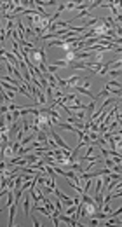 Dermal Fibroblast Cells: Biology and Function in Skin Regeneration