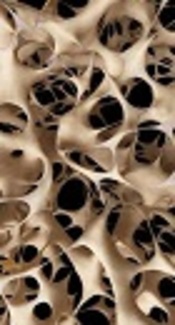 https://www.nof.org/patients/what-is-osteoporosis/