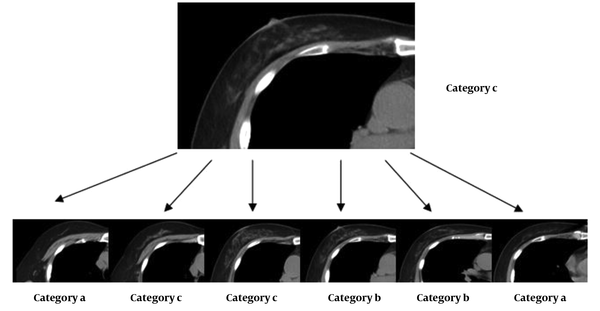 Breast composition classification relative to the highest category based on image readings