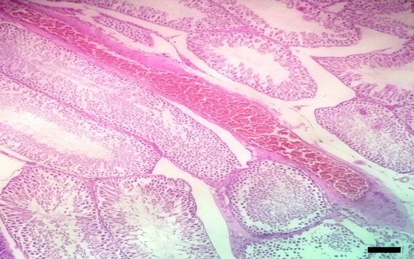 Edema and congestion in testis tissue of a rat from the LD group (H & E, x 100), scale bar = 250 μm.