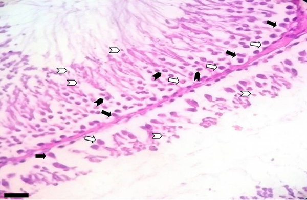 Notable height decrease in the germinative epithelium in a rat from the HD group (H & E, x 400). Black arrow: Sertoli cells, white arrow: spermatogonia, black chevron: primary spermatocytes, white chevron: spermatids, scale bar = 5