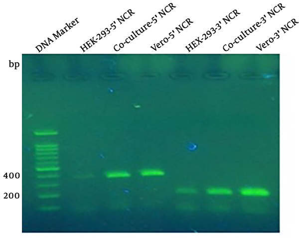 The RT-PCR to amplify 5’NCR and 3’NCR from rescued MV. The amplification results of 5’NCR and 3’NCR showed 392-bp and 184-bp bands. Lane 1 is related to the DNA marker; lanes 2, 3, and 4 are positive amplification results of 5’NCR sequence of transfected HEK-293 cells, rescued measles virus from transfected HEK-293 co-culture cells with Vero cells, and inoculated Vero cells with rescued measles virus, respectively; lanes 5, 6, and 7 are positive amplification results of 3’NCR sequence of rescued measles virus from HEK-293 cells, co-culture system, and inoculated measles virus, respectively.