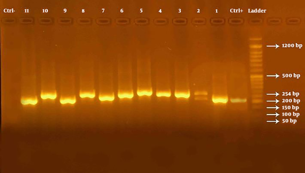 The PCR product of the UL55 gene electrophoresed on the 1.5% agarose gel. 1 - 11, Cytomegalovirus PCR product of the UL55 gene using specific primers on the 1.5% agarose gel. 1 - 11, Cytomegalovirus DNA products containing UL55 gene