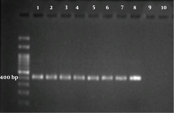 Electrophoresis analysis of nested-PCR product of the gp60 gene for Cryptosporidium spp. 100 bp DNA Ladder, six positive isolates (Lane 1-6), positive control 7 and 8, negative control 9 and 10.