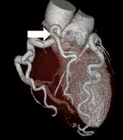 Multidisciplinary Cardiovascular Annals 