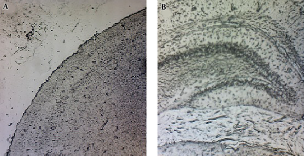 Microscopic inspection of samples showing no sign of Evans blue extravasation in brain tissues; brain parenchyma (A), hippocampus (B) (Magnification ×40).
