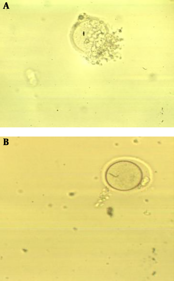 In vitro maturation of oocytes in medium treated with 50 µM of ALA. A) GV oocytes, and B) MII oocytes (40×).