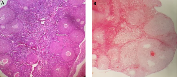 The ovary histology of PCOS and control mice. A) ovarian tissue with atretic follicles and thick granulosa-theca cells; B) ovarian tissue of a control group with several CL (×40).