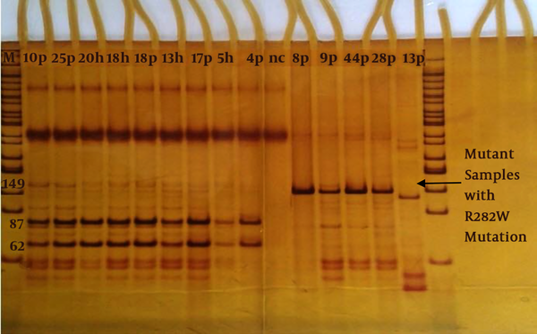 Detection of R282WP53 gene mutation by MspI restriction enzyme on 10% polyacrylamide gel. M; Marker 50 bp, Patient; P, h; health, nc; negative control. Normal samples (87 and 62 bp): 10P, 25P, 18P, 17P, 4P and 20h, 18h, 13h, 5h. Mutant samples with R282W mutation (149 bp): 8P, 9P, 28P 44P and 33p.