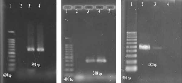 (Gel electrophoresis of PCR products of qnr) qnrB: 1- Lader (100 bp), 2- Negative control, 3- Positive control (594 bp), 4- Positive sample (594 bp): qnrS: 1- Lader (100 bp), 2- Negative control, 3- Positive sample (388 bp), 4- Positive control (388 bp): aac(6’)-Ib-cr: 1- Lader (100 bp), 2- Positive control (482 bp), 3- Positive sample (482 bp), 4- Negative control