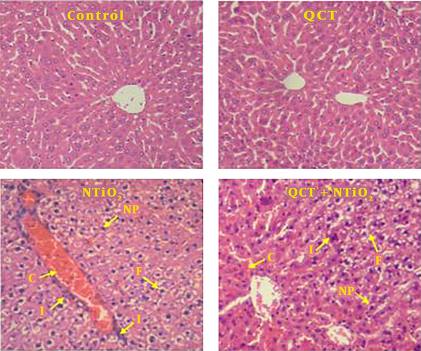 Light microscopy of H&amp;E stained sections of liver from the control and experimental groups. A, control group; B, QCT group; C, NTiO2-intoxicated group; D, QCT + NTiO2 group. C, congestion of RBCs; F, fat deposit; I, infiltration of inflammatory cells; NP, nuclear pyknosis. Magnifications: × 250.
