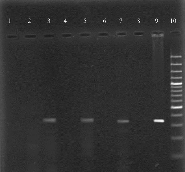 PCR result of CagA gene of H. pylori isolated from positive for Helicobacter pylori patients. Number 1, 2, 4, and 6, negative samples; numbers 3, 5, and 7, positive samples; number 8, negative control; number 9, positive control; number 10, 1 kb DNA ladder.