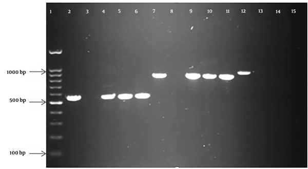 PCR amplified products of β-lactamase genes in the study. Lane 1: 100 bp molecular weight marker; lane 2, 3, 4, 5, and 6: control positive, control negative, and three clinical isolates of blaCTX-M (550 bp); lane 7, 8, 9, 10, and 11: control positive, control negative, and three clinical isolates of blaTEM (800 bp); lane 12, 13, 14, and 15: control positive, control negative, and two clinical isolates of blaPER(925 bp).