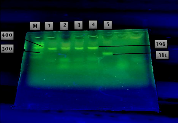 Agarose gel electrophoresis of the GAP-PCR products related to Insertion and Deletion mutation of the ApoA1 gene in the patients with ALL (lanes 1 - 5). A fragment with 396bp yielded in lanes 1 - 4 related to the insertion mutation as a genotype of II. The other fragment with 361 bp (lane 5), related to deletion mutation as a genotype of DD. Markers of known length were run in lane M.