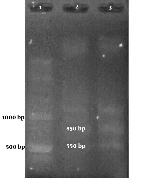 The PCR product of positive control in agarose gel electrophoresis.