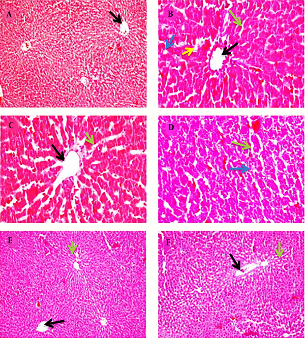 Histo-Micrograph of Rat Liver From Different Treatment Groups. A: Normal histoarchitecture of rat liver (×10); B: Altered hepatocyte histoarchitecture of CCl4-treated rats (×40); C: Liver histoarchitecture of irradiated chicory root extract + CCl4-treated rats (×40); D: Histoarchitecture of non-irradiated chicory root extract + CCl4-treated rats (×40); E: Histoarchitecture of irradiated chicory root extract treated rats (×10); F: Histoarchitecture of non-irradiated chicory root extract treated rats (×10). Central vein (Black arrow), necrosis (blue arrow), sinusoid (green arrow), and ballooning degeneration of hepatocytes (yellow arrow).