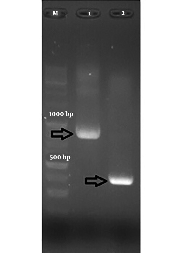 HPV fragment PCR product. Lane M, 100 bp DNA ladder, lane 1, 850 bp product for HPV18; lane 2, 300 bp product for HPV33.