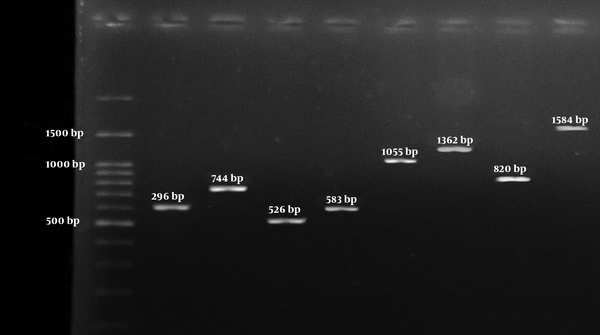 Left to right respectively: 100-bp DNA Ladder (Fermentas, UK); The 596 bp PCR product of clfB encoding gene; The 744 bp PCR product of cna encoding gene; The 526 bp PCR product of ebp encoding gene; The 583 bp PCR product of mecA encoding gene; The 1055 bp PCR product of bbp encoding gene; The 1362 bp PCR product of fnbA encoding gene; The 813 bp PCR product of fnbB encoding gene; and the 1584 bp PCR product of clfA encoding gene.