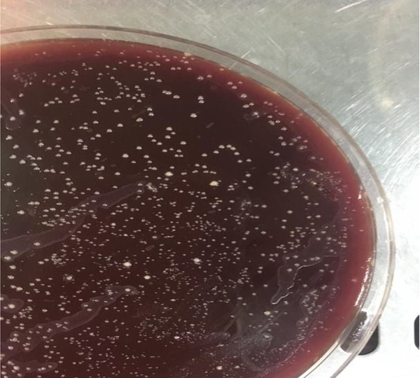 Positive culture of Helicobacter pylori on Brucella blood agar media