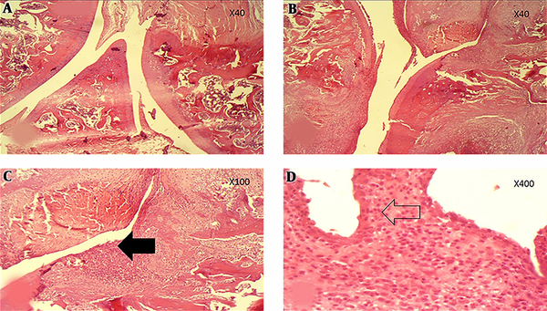 Histopathological evaluation of articular space. (A) Section shows normal articular space without any erosion or destruction in the controls (H&amp;E, ×40). (B &amp; C) Articular surface destruction in conjunction with cartilage loss pointed by filled arrow (H&amp;E, ×40 &amp; ×100) associated with acute synovial inflammation. (D) The arrow is representative of inflammatory cells involved in arthritis (H&amp;E, ×400).