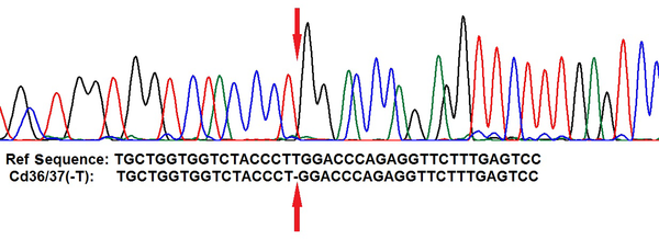 Sequencing result of the embryo 5 with forward primer in comparison to the reference sequence