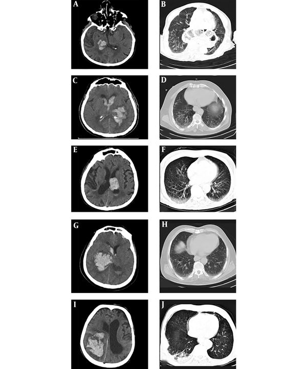 Brain and Lung CT scan of five patients