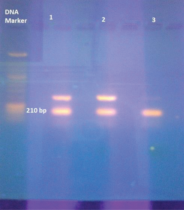 The 210 bp fragment of the amplified product displaying a positive band when exposed to UV light after gel electrophoresis; 1-3 represent the clinical isolates of Mycobacterium tuberculosis.