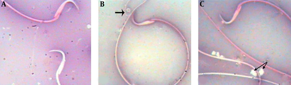 Eosin-nigrosin Staining Technique A) Sperms with Stained Head (dead) and Unstained Sperms (normal); B) Dead Sperms with Abnormal Tail (arrow); C) Abnormal Sperms with Cytoplasmic Droplet (arrows; 1000×)